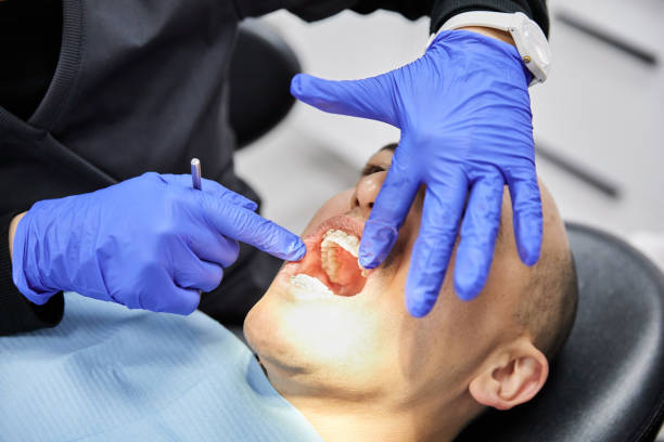 Best Urgent Care for Lost Fillings or Crowns in King Arthur Park, MT